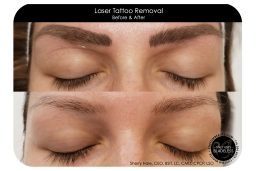 Beaute Solutions Arizona, Sherry Hale - Eyeliner and Brow Laser Tattoo Removal in Phoenix Arizona